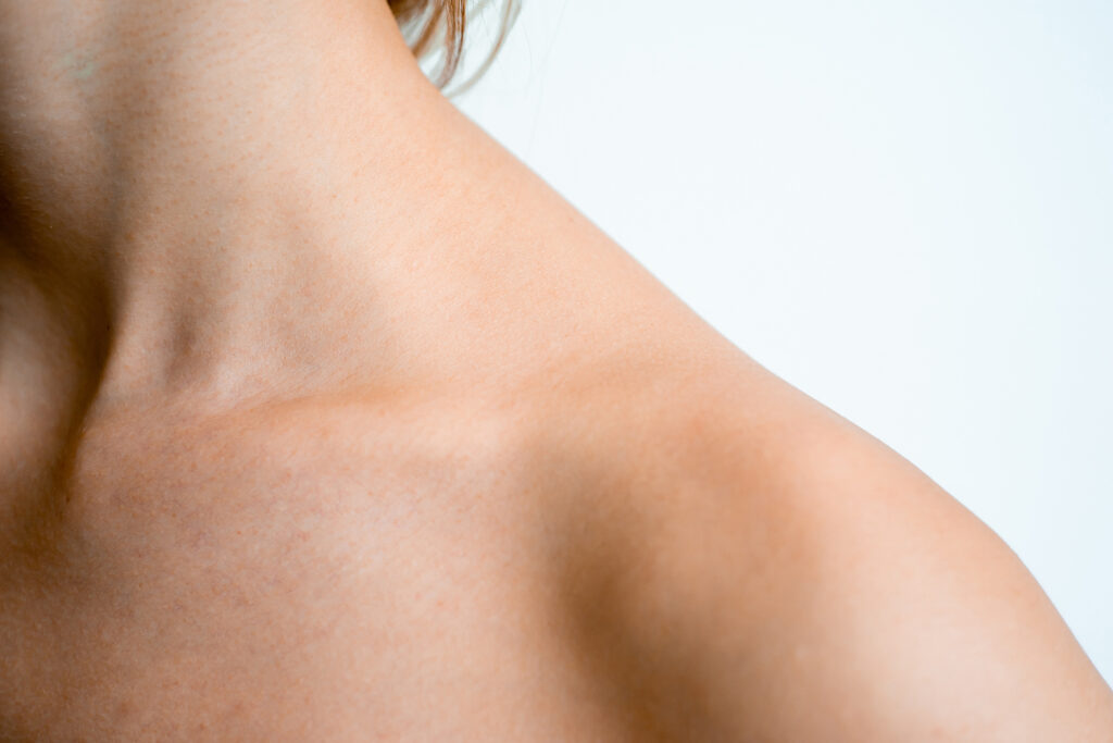 Conditions treated with intralesional injections at Glow Theory in Carlsbad