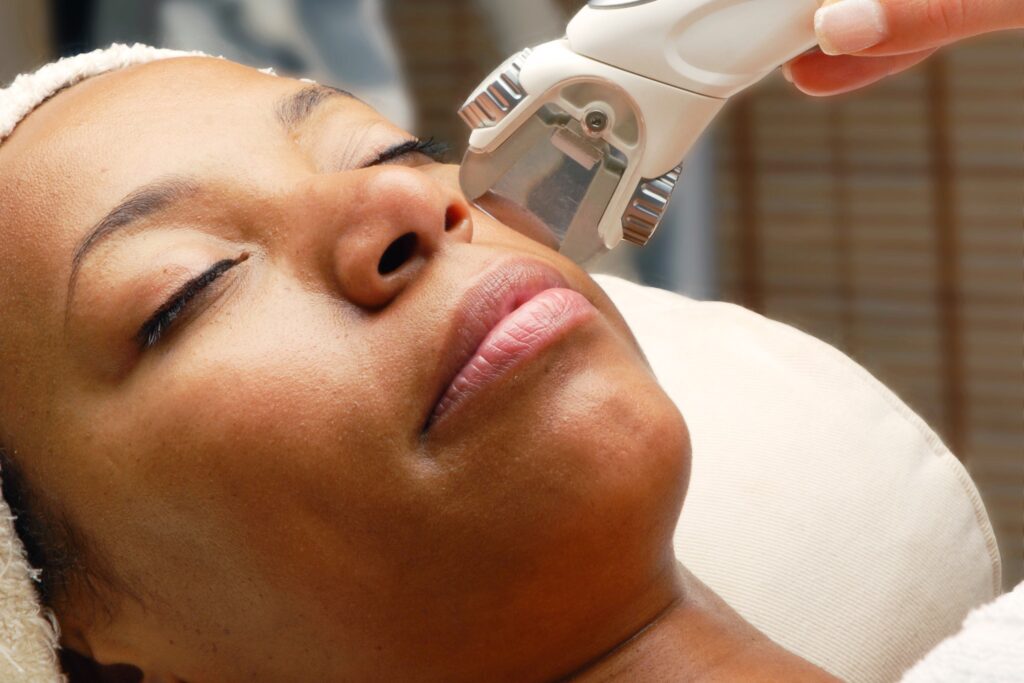 Laser Hair Removal For African American Skin