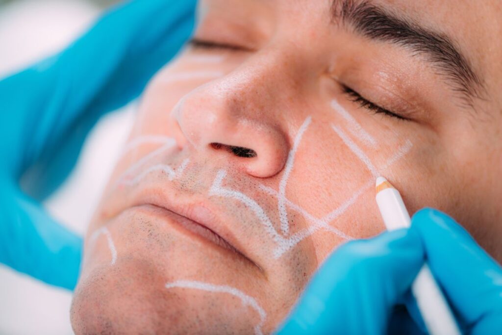 Filler dissolving process at Glow Theory Carlsbad