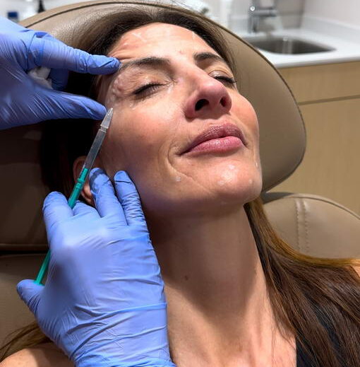 Botox being injected into the crow’s feet area at Glow Theory in Carlsbad