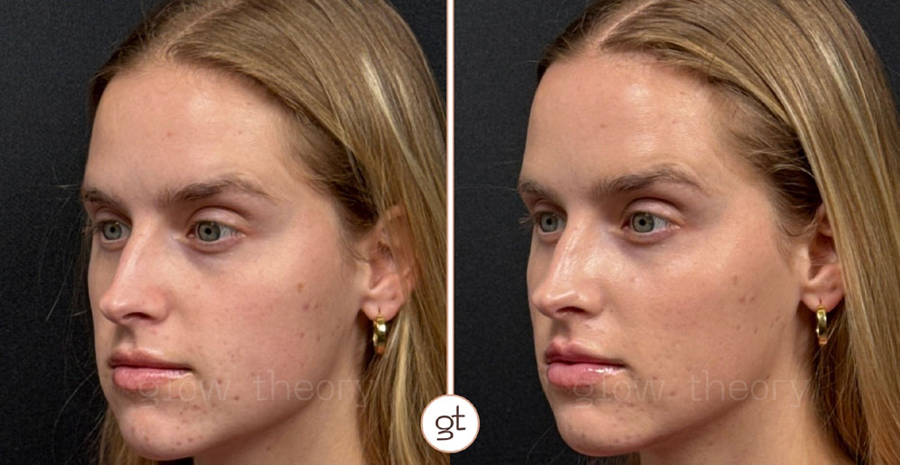 Wedding Glow Up results at Glow Theory in Carlsbad