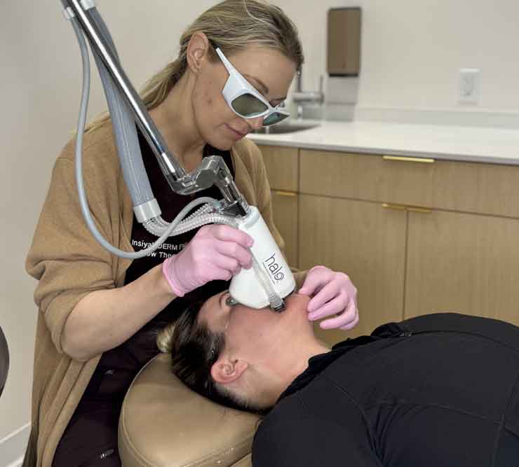 Benefits of HALO laser skin treatment at Glow Theory in Carlsbad