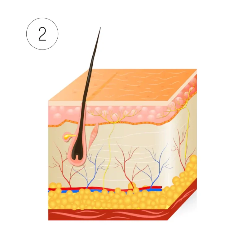 Chemical peel phase 2: fresh, even skin is revealed