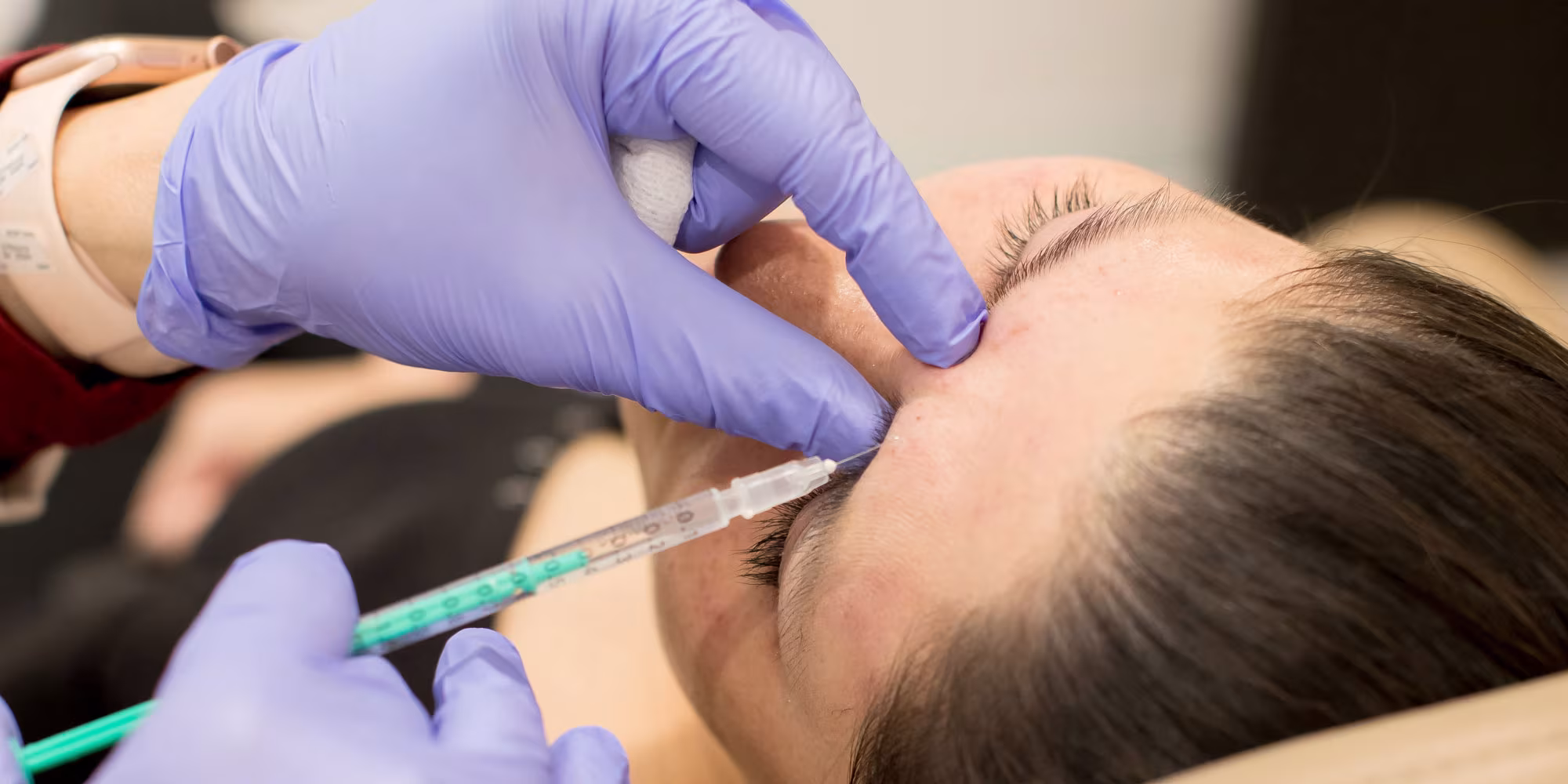 Dysport injection at Glow Theory Aesthetic & Dermatology Studio in Carlsbad
