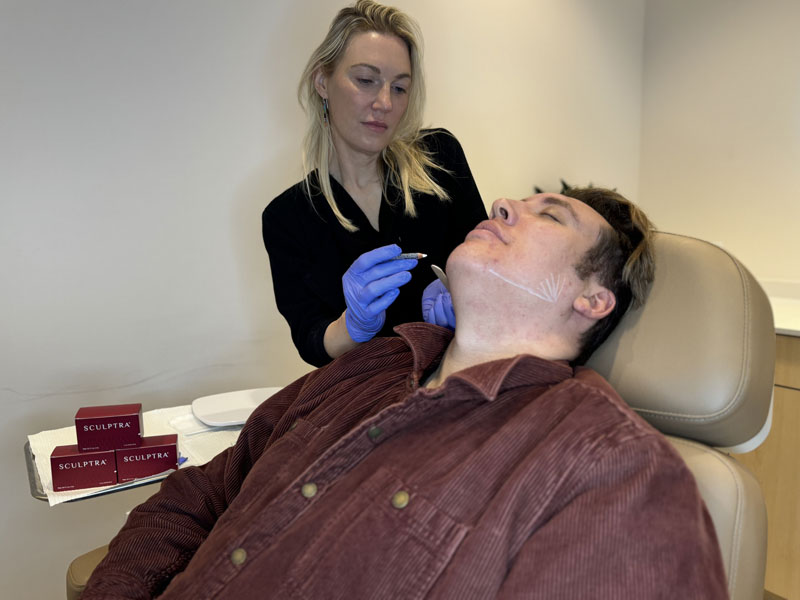 How Sculptra works: a Glow Theory injector treating the cheek