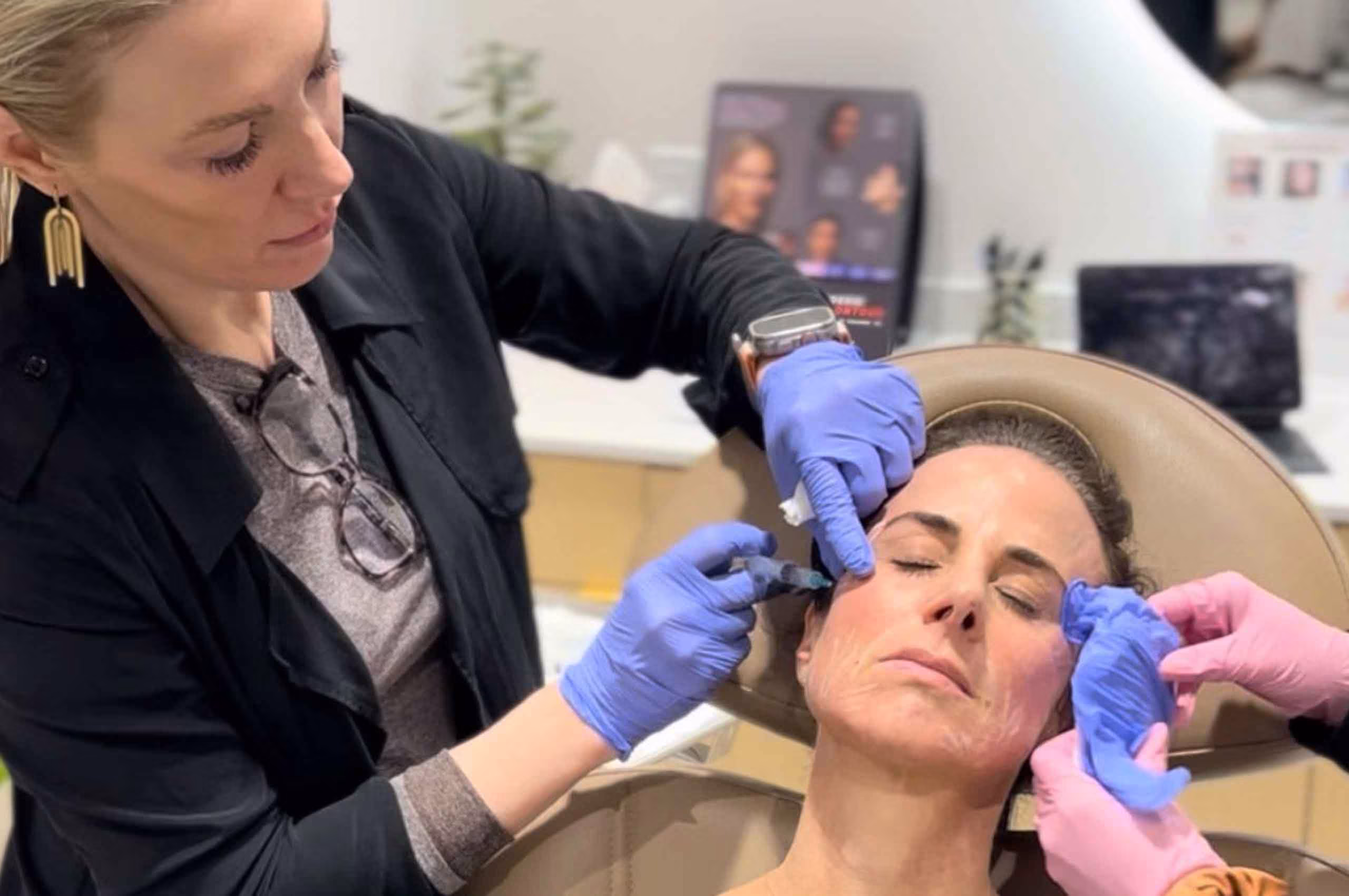 Sculptra collagen treatment at Glow Theory Aesthetic & Dermatology Studio in Carlsbad