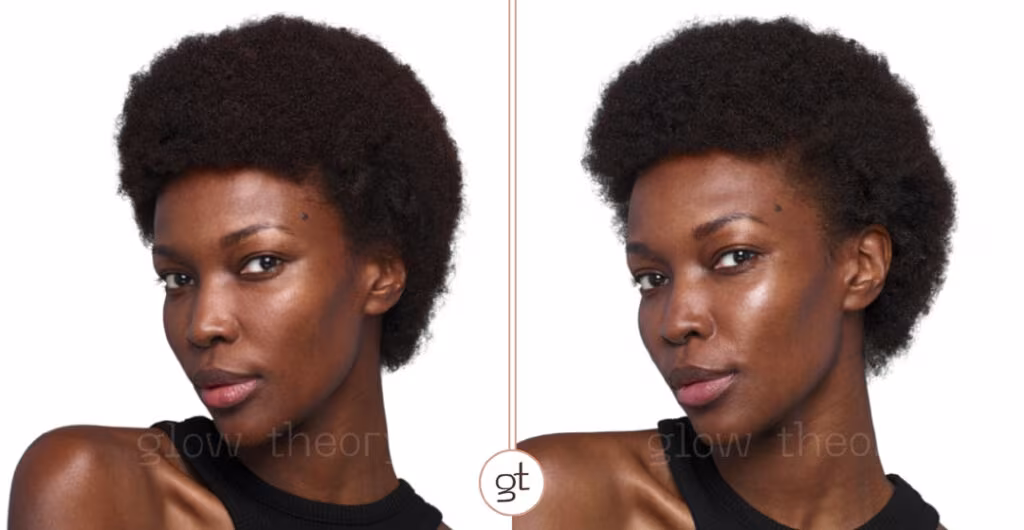 SKINVIVE Result 1 before and after