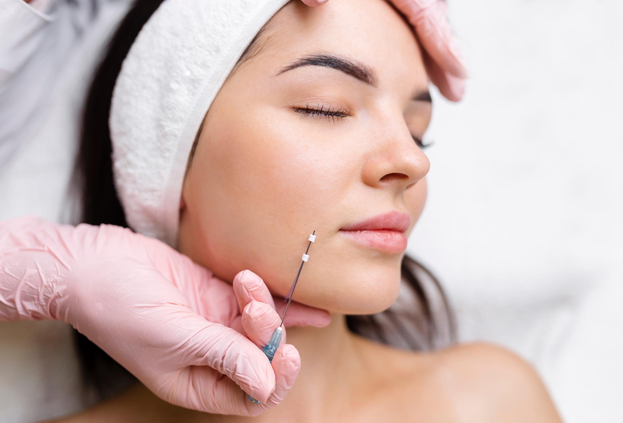PDO thread lift at Glow Theory Aesthetic & Dermatology Studio in Carlsbad
