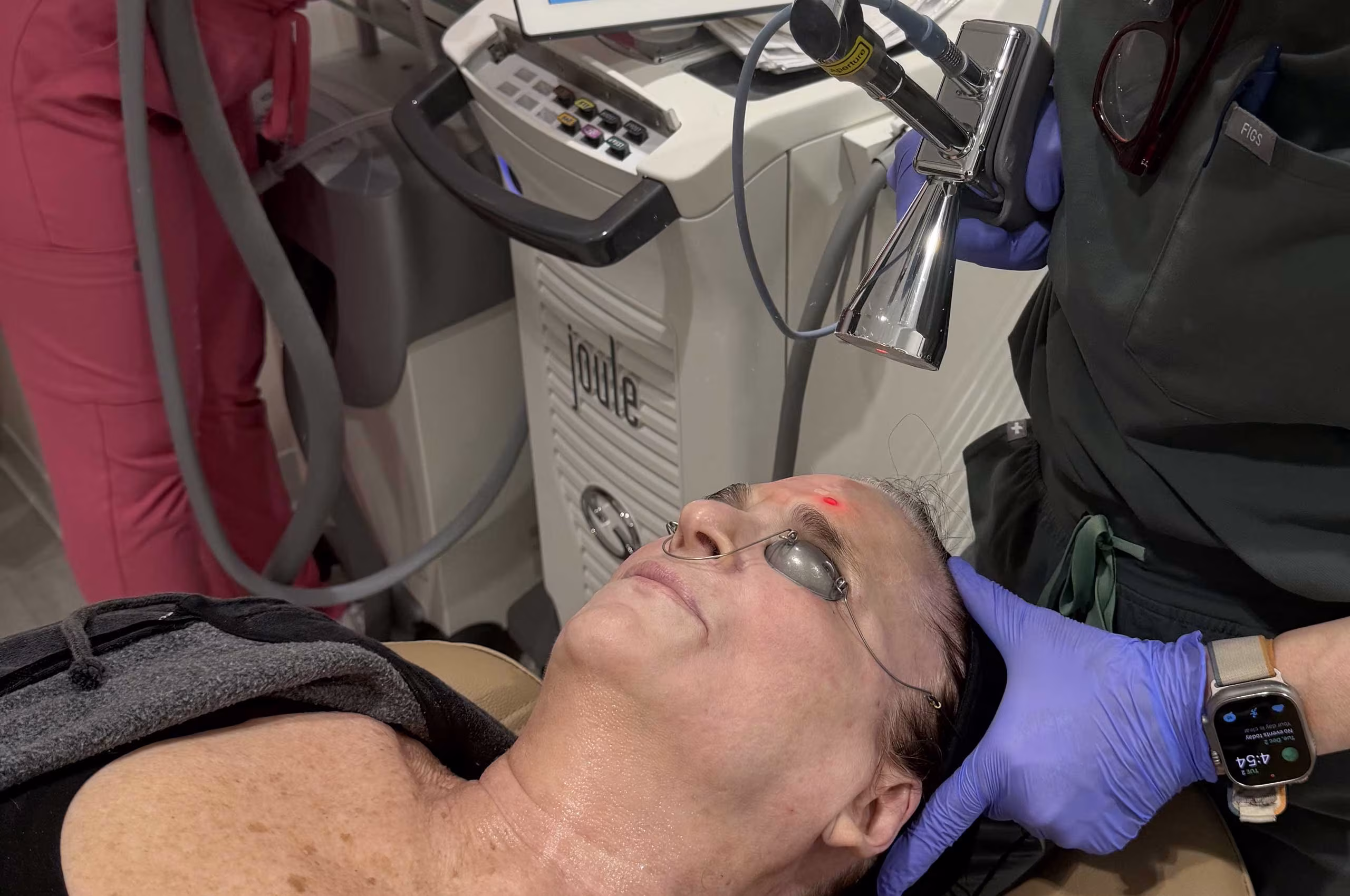 Erbium laser resurfacing treatment at Glow Theory Aesthetic and Dermatology Studio in Carlsbad.