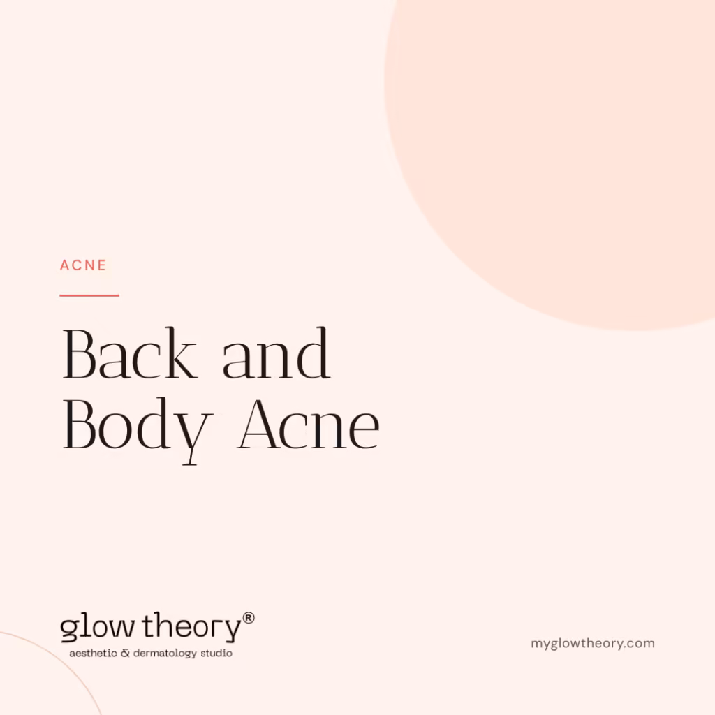 Back and Body Acne. Glow Theory Aesthetic & Dermatology Studio, Carlsbad