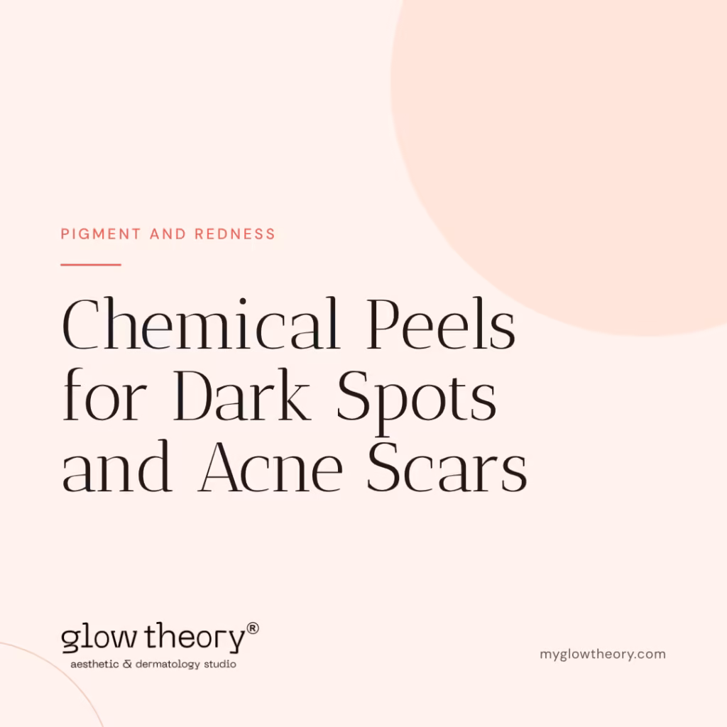 Chemical Peels for Dark Spots and Acne Scars. Glow Theory Aesthetic & Dermatology Studio, Carlsbad