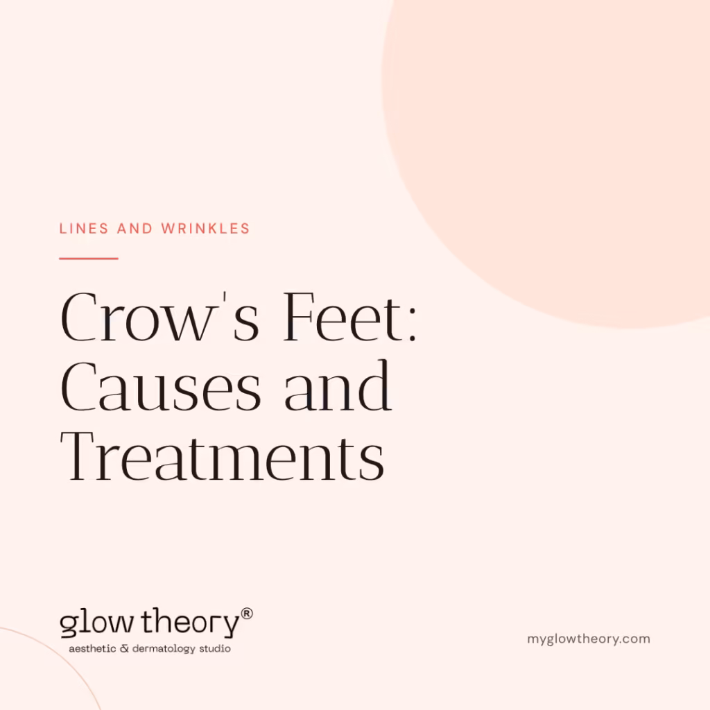 Crow's Feet: Causes and Treatments. Glow Theory Aesthetic & Dermatology Studio, Carlsbad