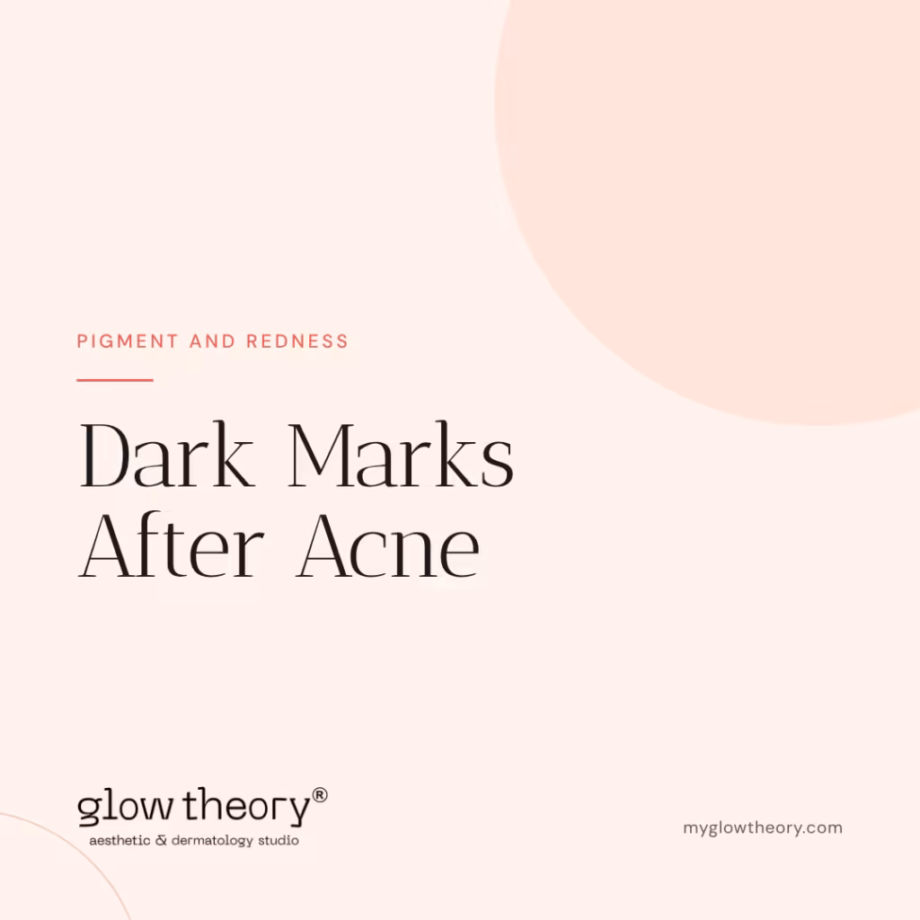 Dark Marks After Acne. Glow Theory Aesthetic & Dermatology Studio, Carlsbad