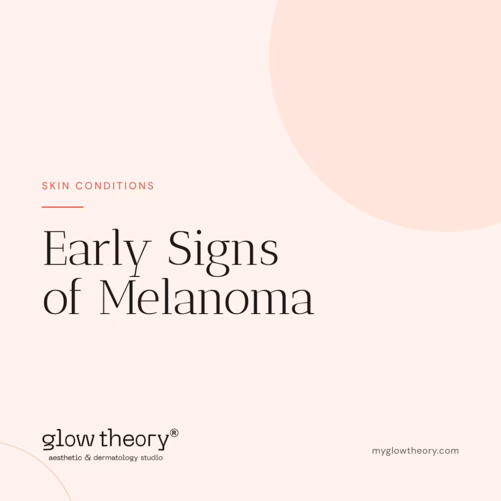 Early Signs of Melanoma. Glow Theory Aesthetic & Dermatology Studio, Carlsbad