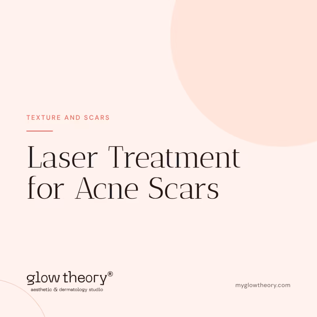 Laser Treatment for Acne Scars. Glow Theory Aesthetic & Dermatology Studio, Carlsbad