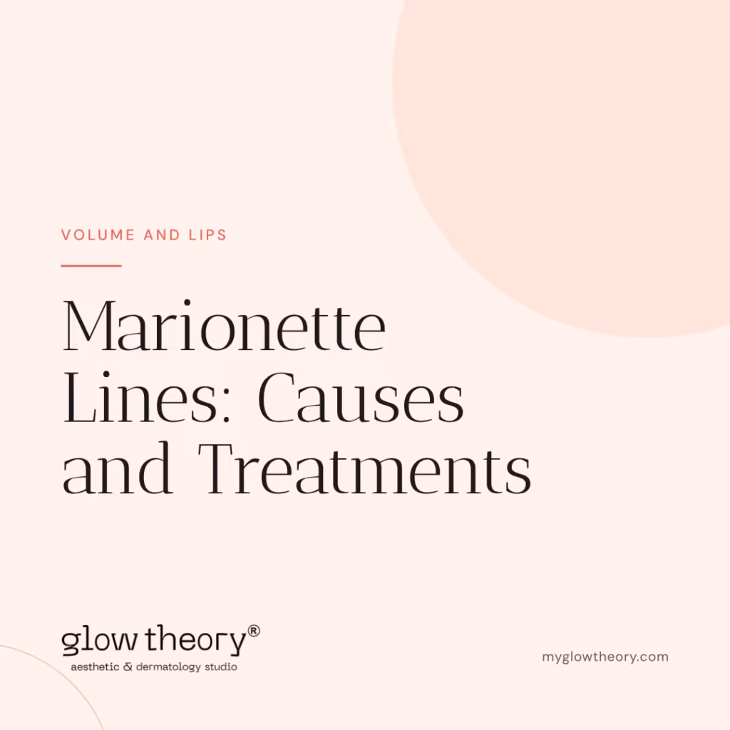 Marionette Lines: Causes and Treatments. Glow Theory Aesthetic & Dermatology Studio, Carlsbad