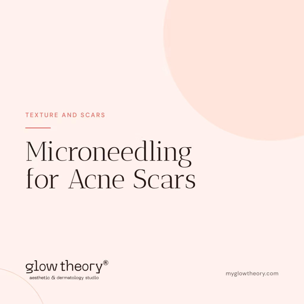 Microneedling for Acne Scars. Glow Theory Aesthetic & Dermatology Studio, Carlsbad