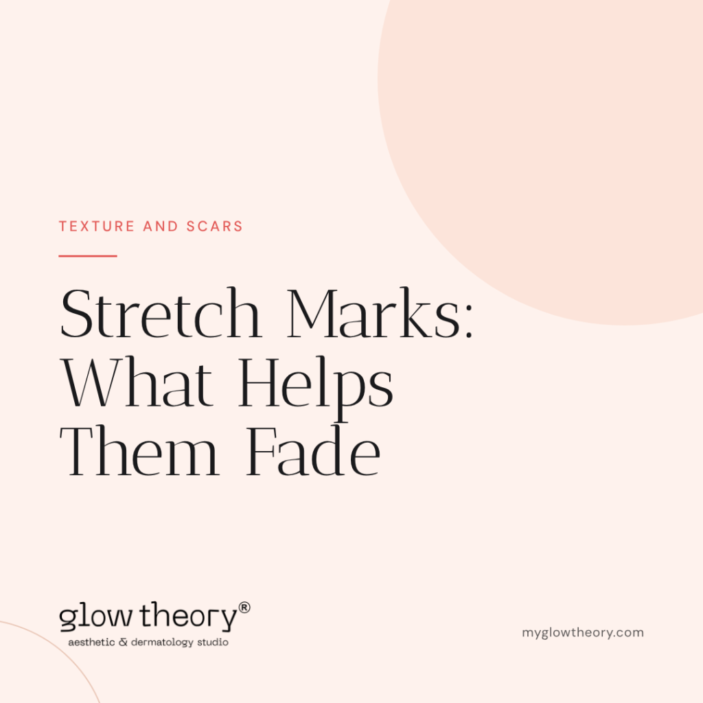 Stretch Marks: What Helps Them Fade. Glow Theory Aesthetic & Dermatology Studio, Carlsbad