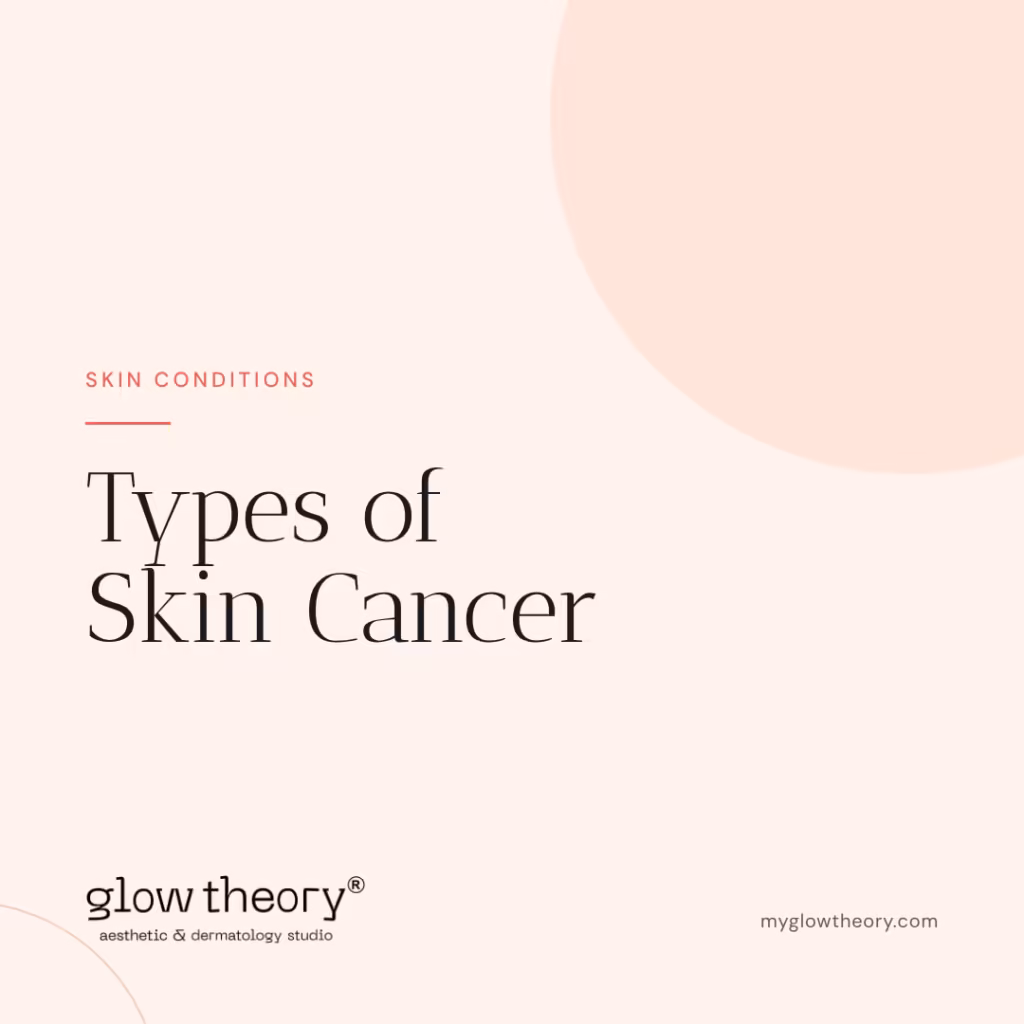 Types of Skin Cancer. Glow Theory Aesthetic & Dermatology Studio, Carlsbad