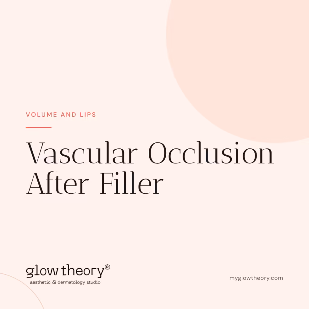 Vascular Occlusion After Filler. Glow Theory Aesthetic & Dermatology Studio, Carlsbad